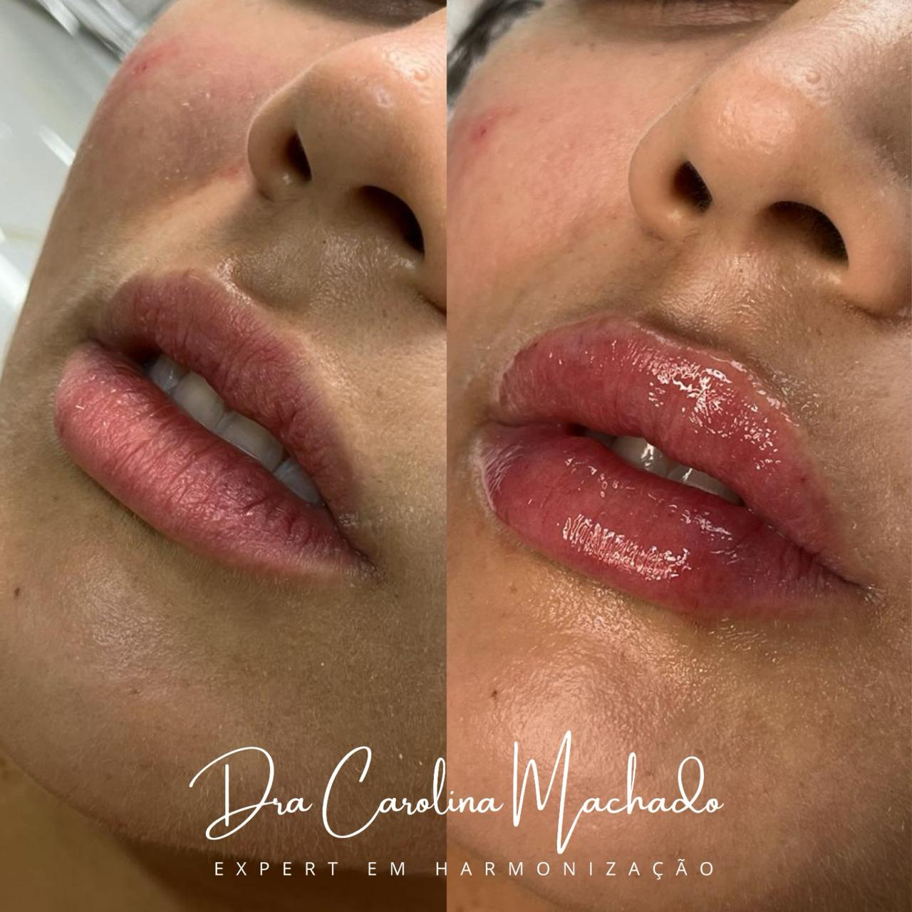 clinica-de-estetica-harmonizacao-facial